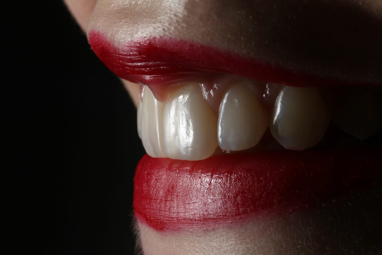 Personne tenant une cigarette, dents visibles légèrement colorées, illustration de l'impact du tabac sur la teinte dentaire.