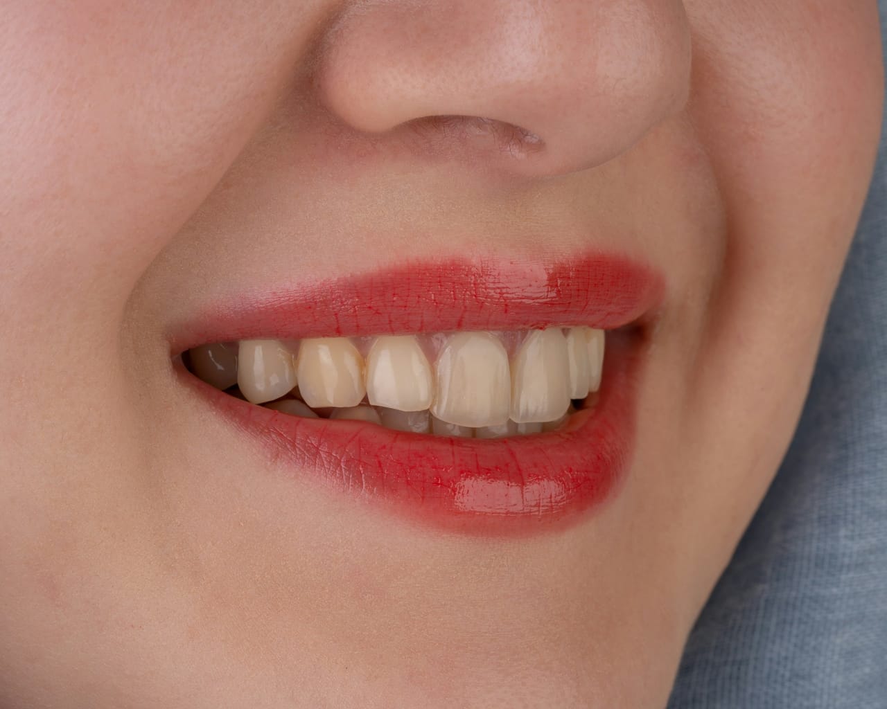 Produits Oral-B pour le blanchiment dentaire : dentifrice 3D White, brosse électrique et kit Whitening Strips posés ensemble.