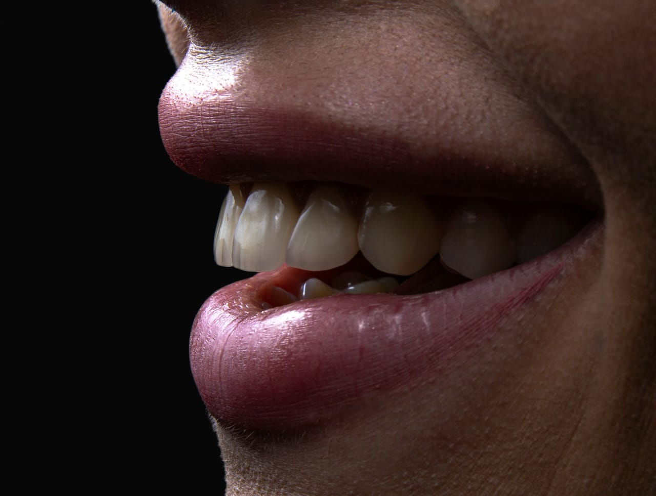 Vue rapprochée de dents présentant des colorations différentes, illustrant la distinction entre teinte jaune et teinte grise.